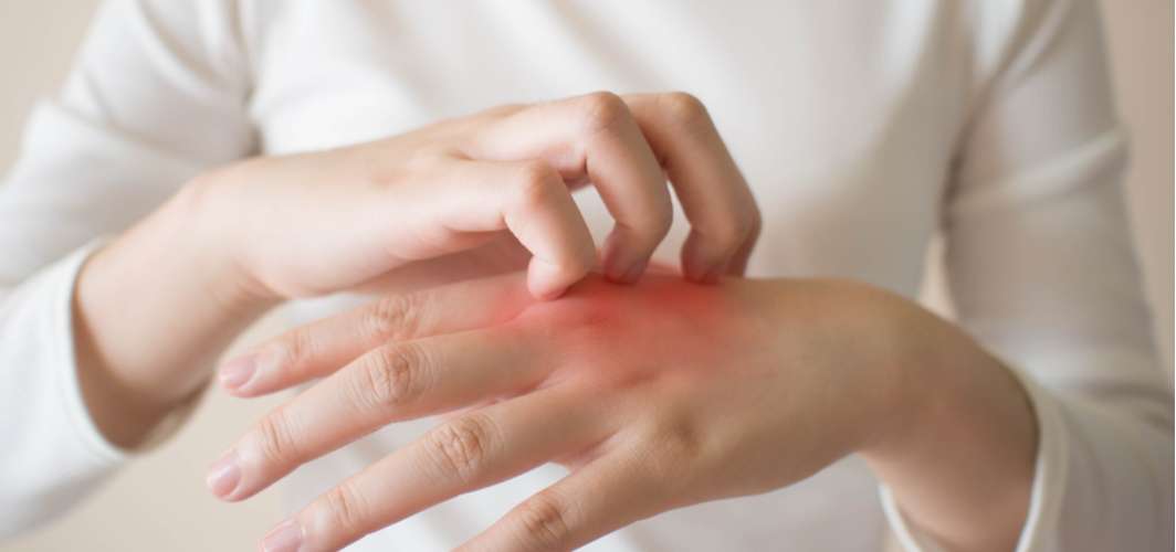 Mucormycosis: Black Fungal Infection in COVID-recovered Patients