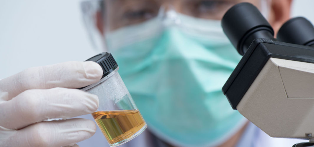 Which Diseases Can Be Diagnosed With A Urine Test?