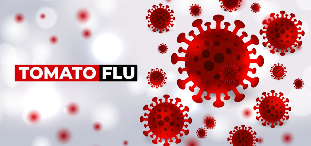 Tomato Flu What It Is And How To Stay Safe From It?