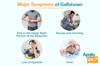 gall bladder stone symptoms