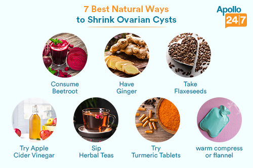 7naturalwaystoshrinkovariancysts