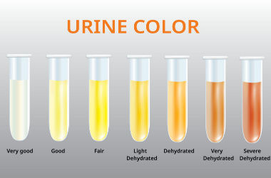 urine colour