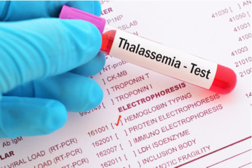 Thalassemia-test