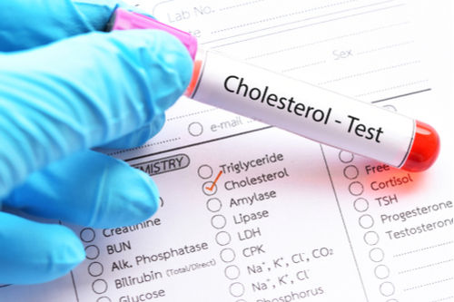 cholesterol_test