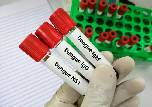 dengue profile test