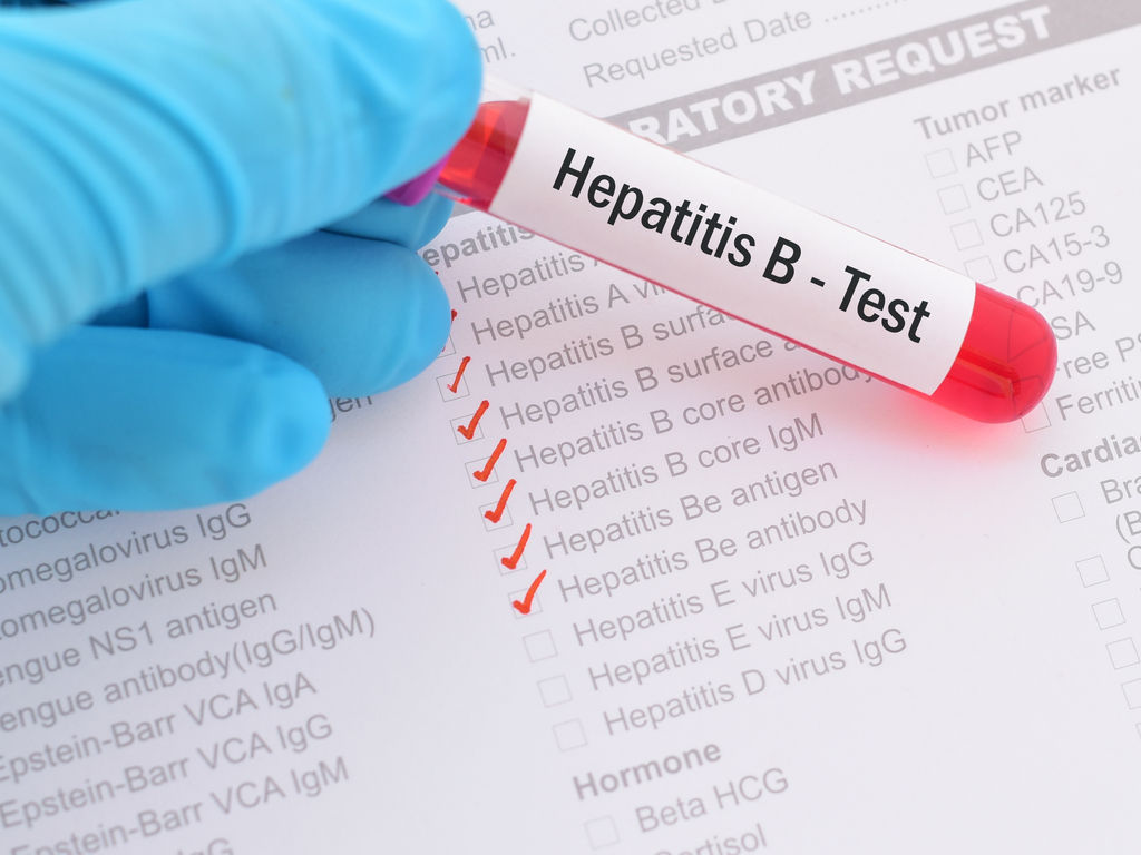 hepatitis B test