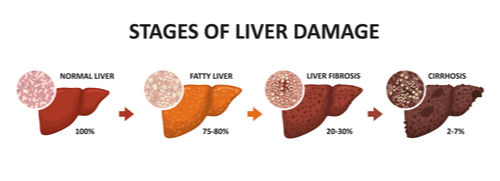 liver_damage