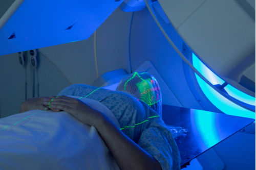 radiotherapy