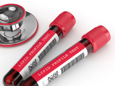 lipid profile