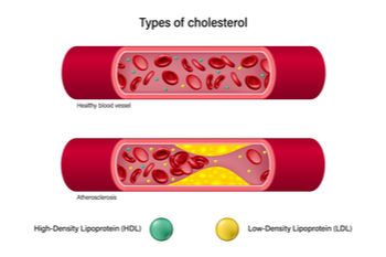 cholesterol