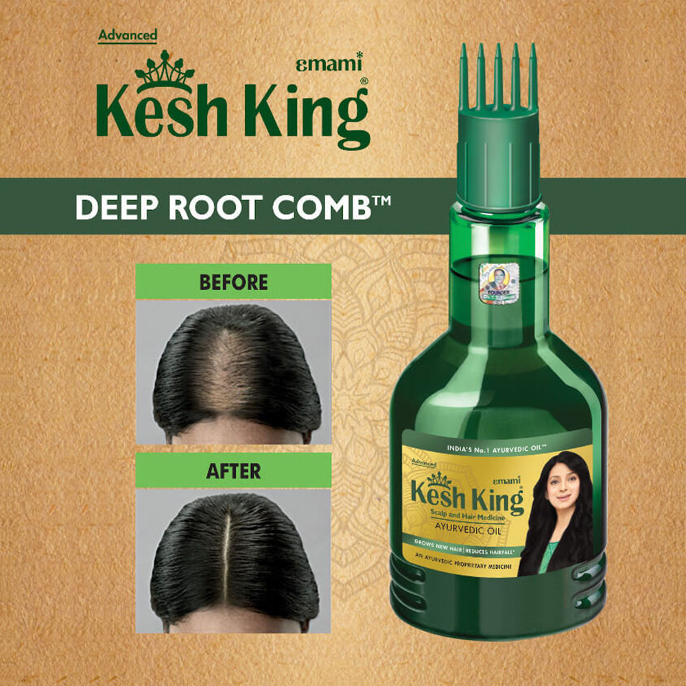 Kesh King Ayurvedic Scalp and Hair Medicine Oil, 300 ml, Pack of 1 
